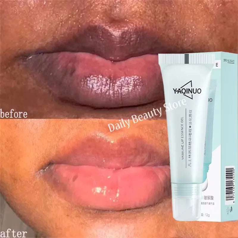 Dark Lip Lightening Balm