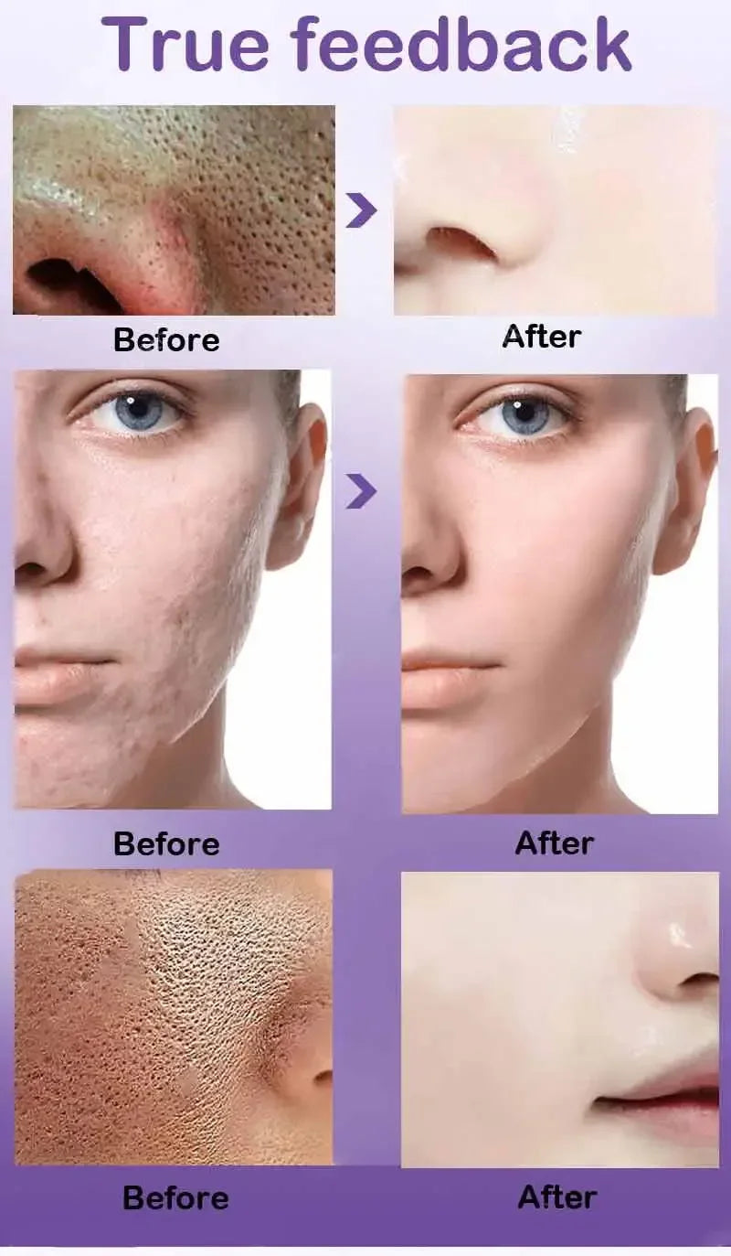 Retinol & Niacinamide Brightening Serum