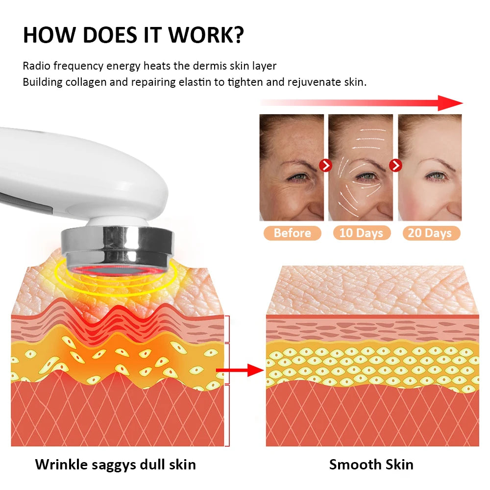 RF Facial Skin Tightening Device