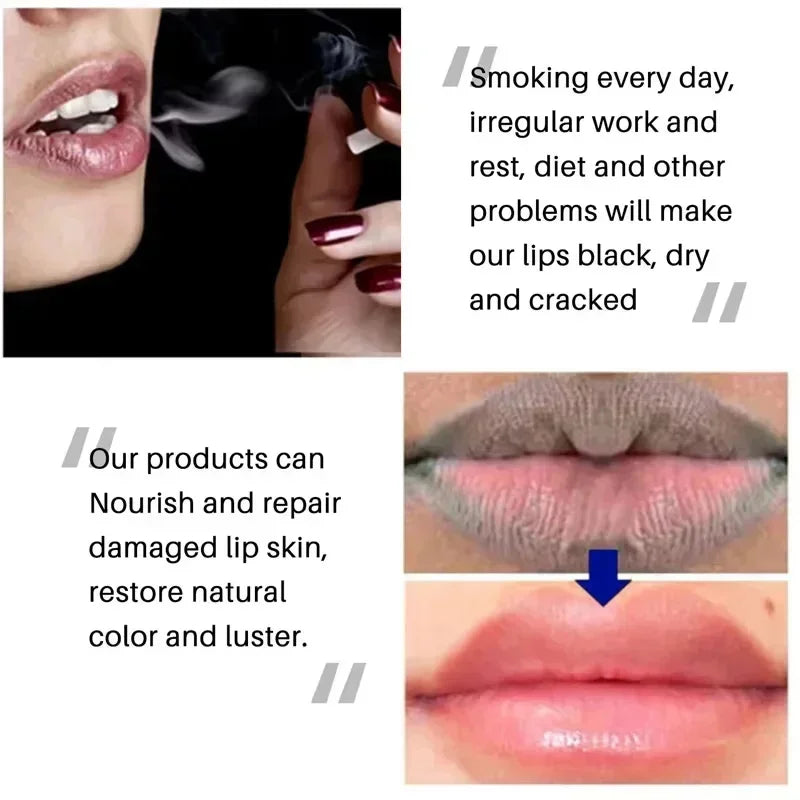 Dark Lip Lightening Balm