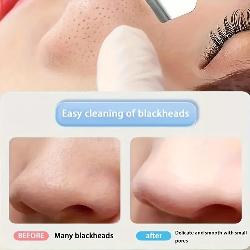 2-in-1 Blackhead Remover