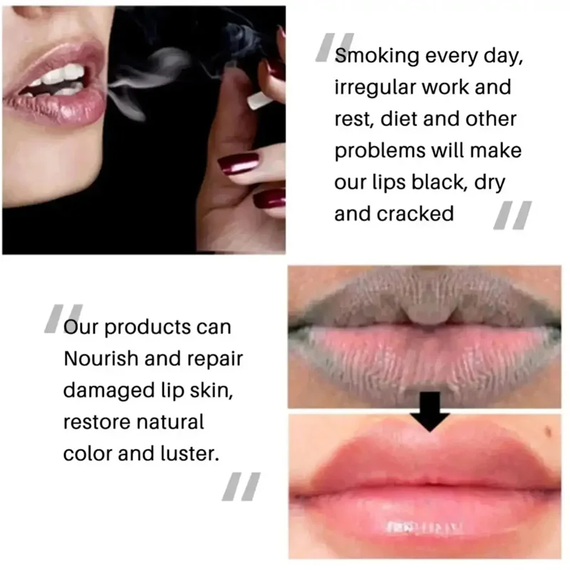 Dark Lip Lightening Balm