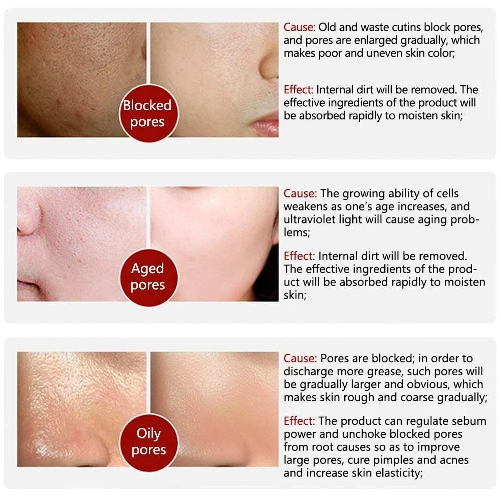 Retinol & Niacinamide Brightening Serum