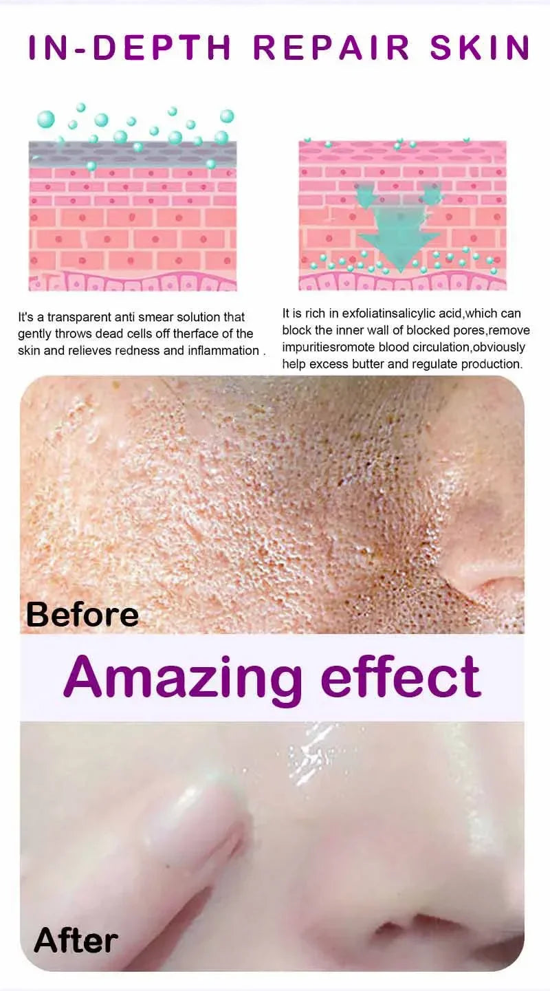 Retinol & Niacinamide Brightening Serum