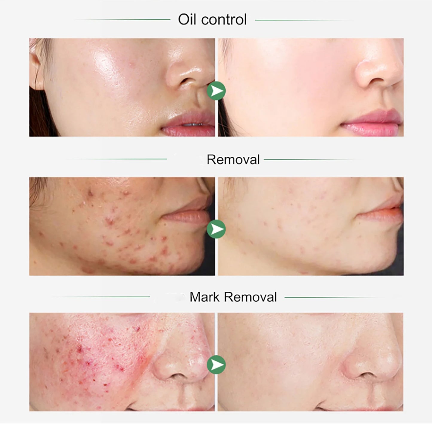 AILKE Turmeric & Vitamin C Skincare Set