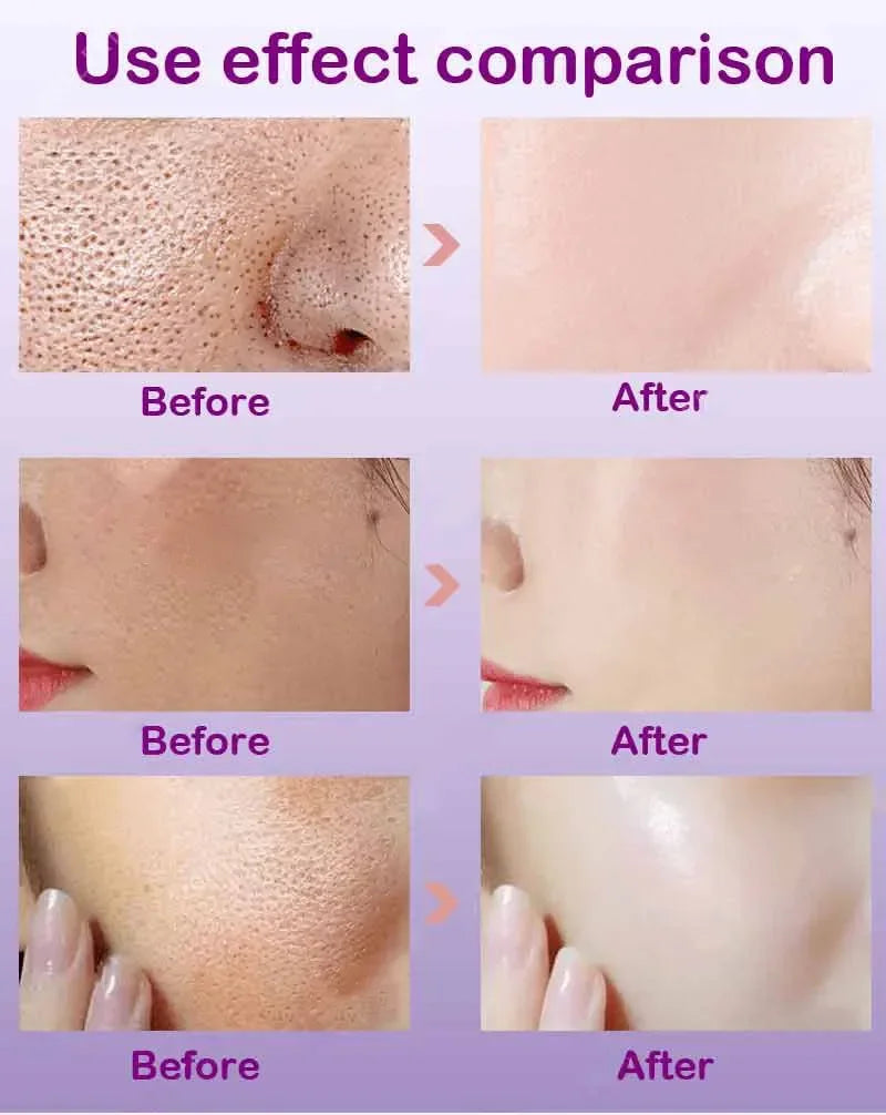 Retinol & Niacinamide Brightening Serum