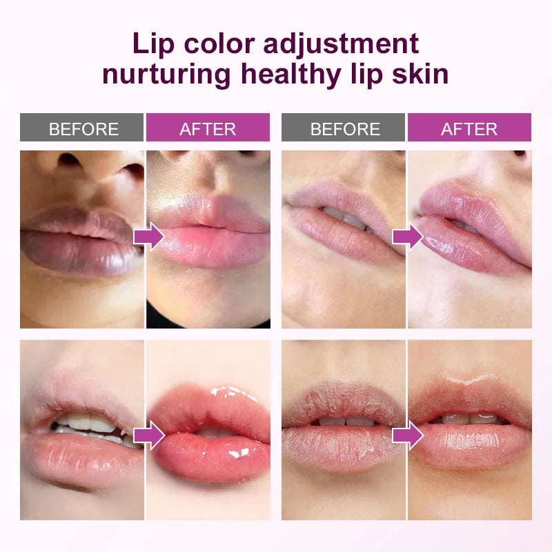 Dark Lip Lightening Balm