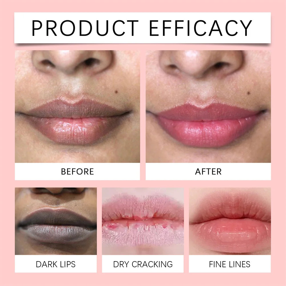 Dark Lip Lightening Balm