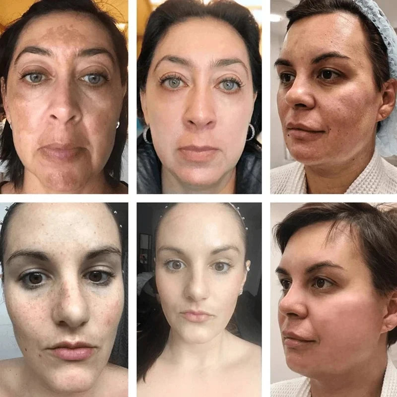 Face Brightening Cream