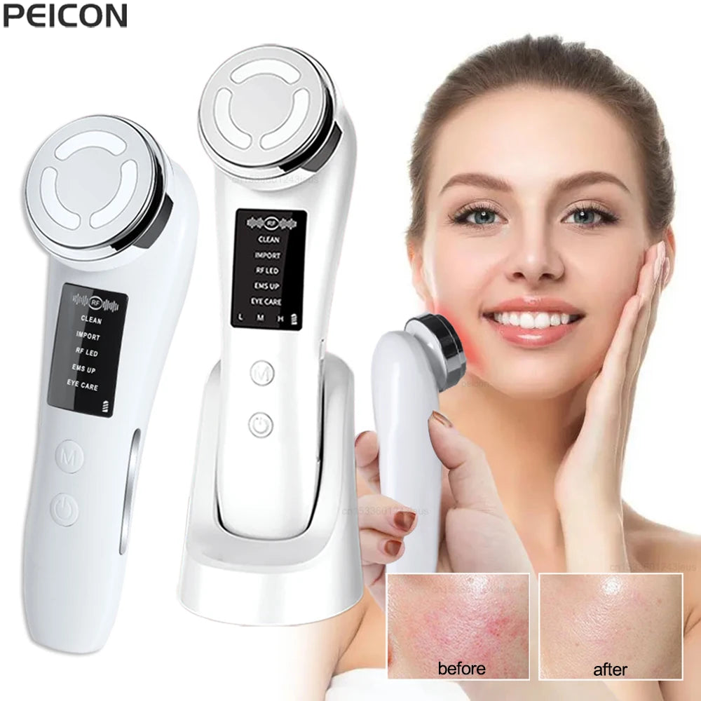 RF Facial Skin Tightening Device