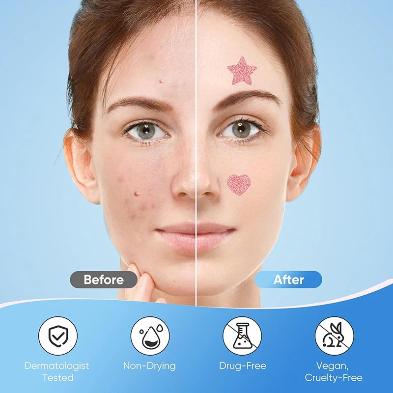 Pimple Patches (156pc)
