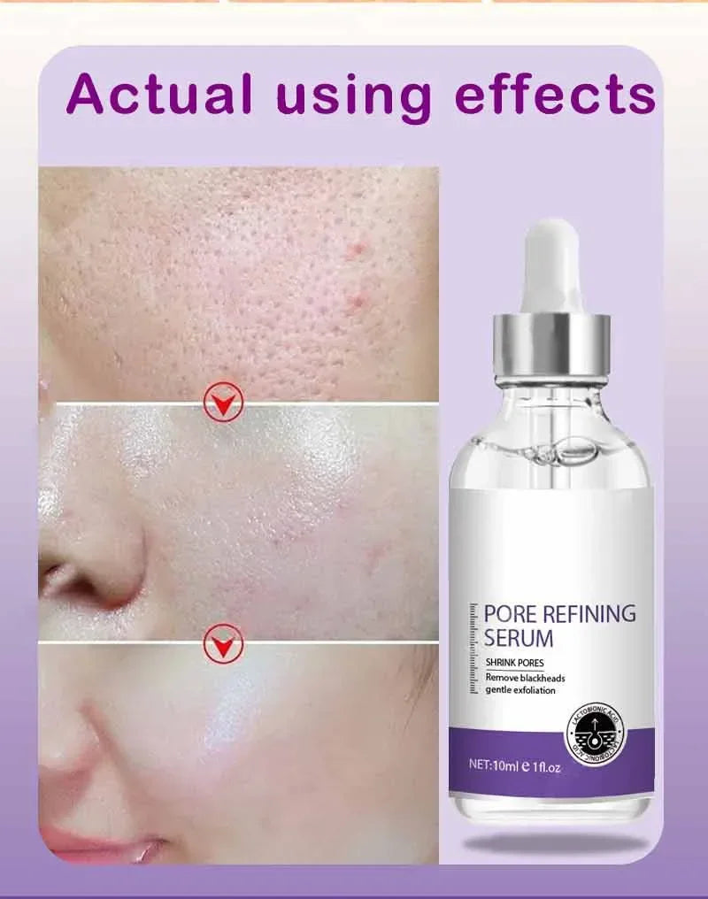 Retinol & Niacinamide Brightening Serum
