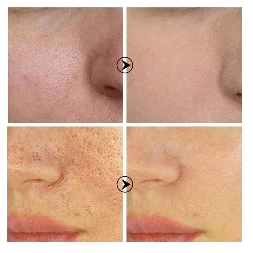 Retinol & Niacinamide Brightening Serum
