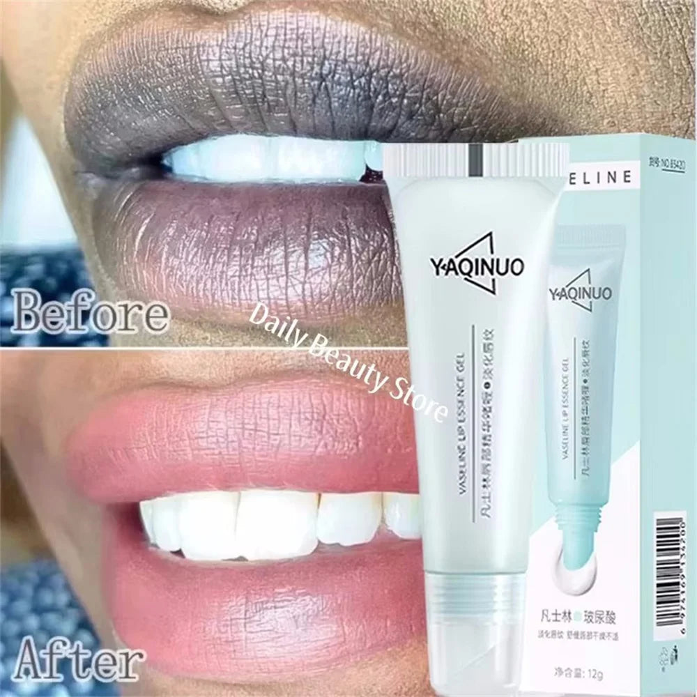 Dark Lip Lightening Balm