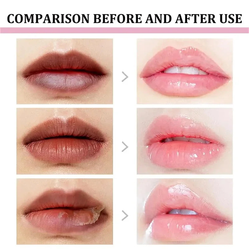 Dark Lip Lightening Balm