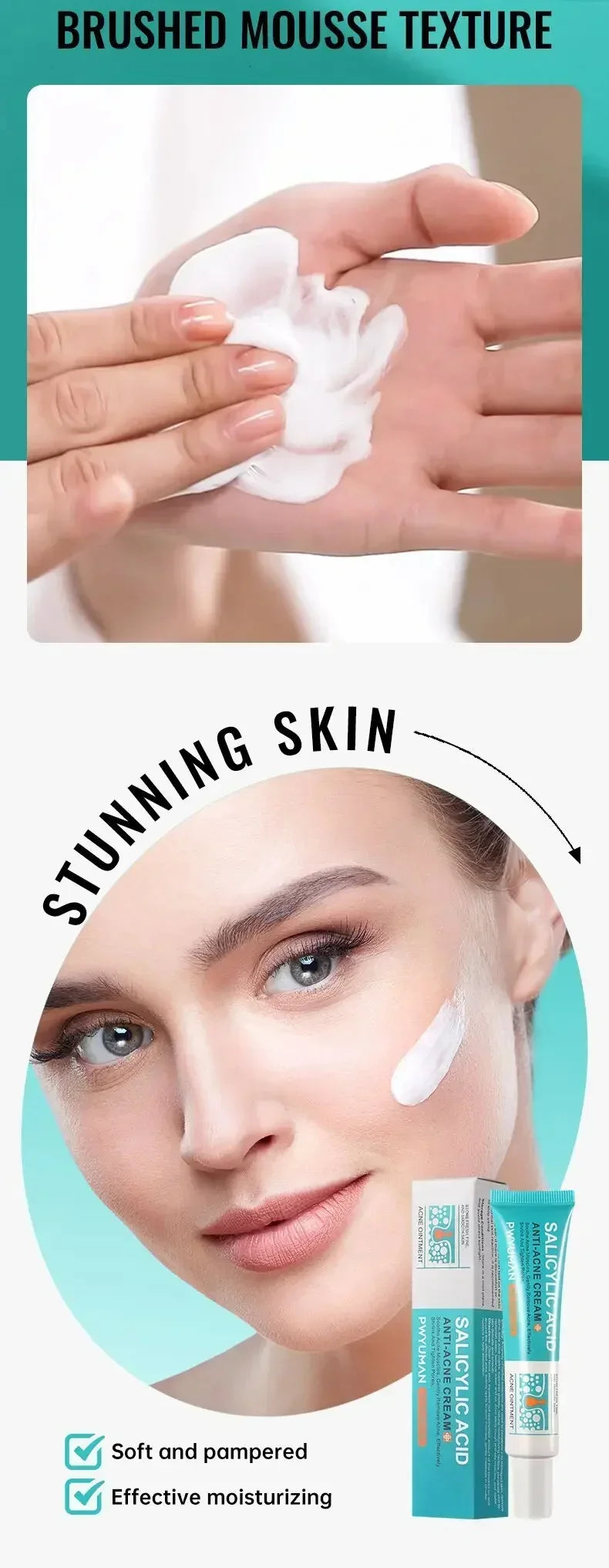 Salicylic Acid Acne Cream
