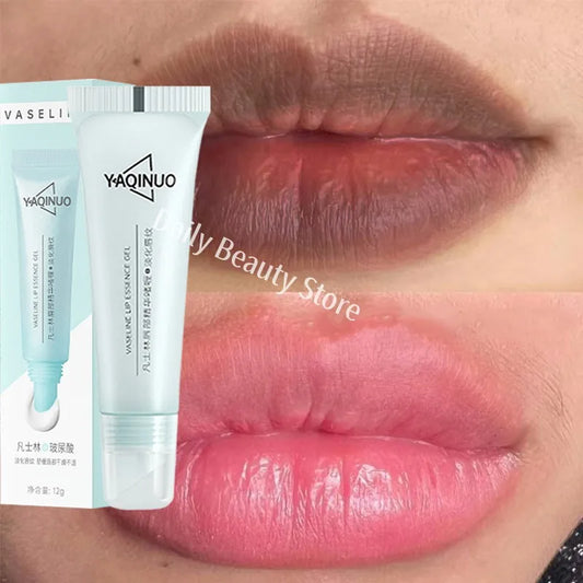 Dark Lip Lightening Balm
