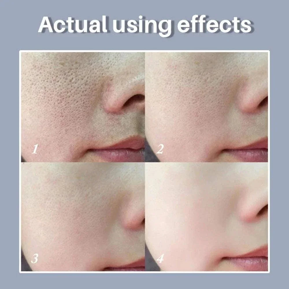 Retinol & Niacinamide Brightening Serum